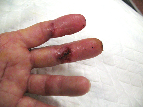 fingers13dec11